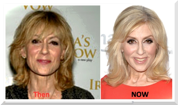 Judith Ellen Light Plastic Surgery – What’s With The Made-Up Beauty