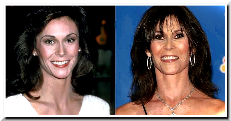 Kate Jackson Plastic Surgery – Is it another fake beauty?